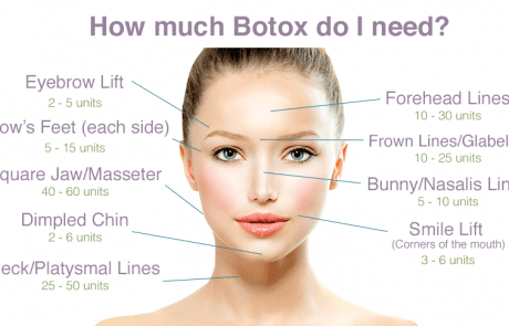 botox®-brotox